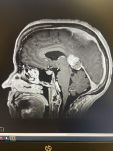 Last Year When I had Brain Cancer - Defying cancer, Searching for Truth 9 IMG 5458