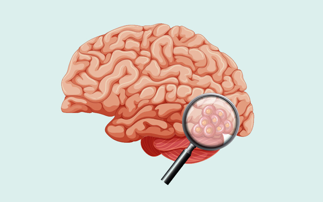 The Brain’s Amazing Ability to Regenerate: Neurogenesis & My Journey